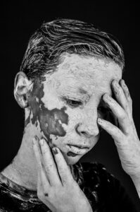 指先のひび割れを防ぐための効果的な対策は？